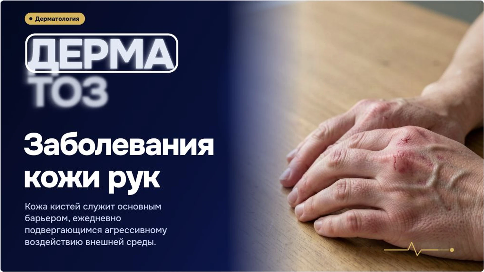 Обложка: Заболевания кожи рук: признаки и диагностика
