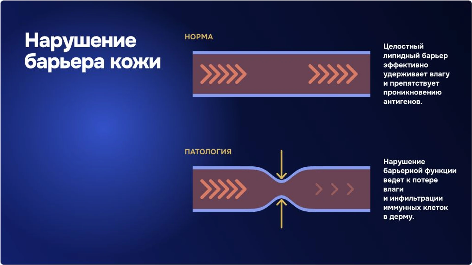 Слайд 4 «Нарушение барьера кожи» из презентации «Заболевания кожи рук: признаки и диагностика».